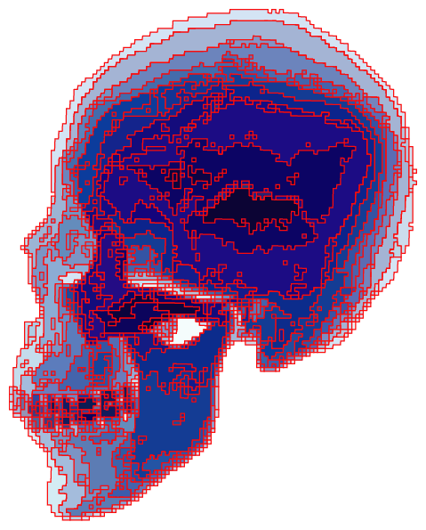 Orthography of the skull - by Tony Karp